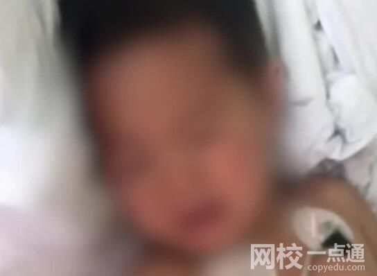 3歲男童路遇烈犬掙脫狗繩撕咬 背后真相實(shí)在讓人驚愕