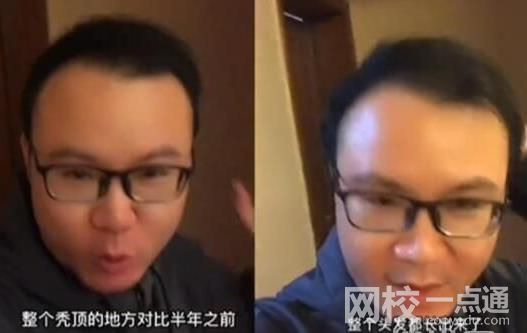 男子回應“不用洗發(fā)水變滿頭黑發(fā)” 具體是什么情況?