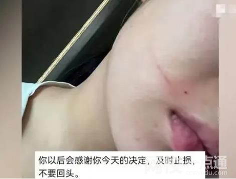 女子懷孕近7個(gè)月被丈夫施暴 女子表示不原諒會(huì)將小孩引產(chǎn)