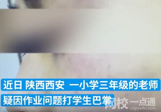 連扇學生數十耳光涉事老師被拘 內幕曝光簡直太意外了