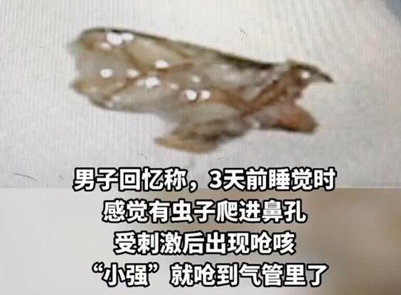 男子睡夢中蟑螂從鼻孔嗆進(jìn)氣管 實(shí)在太嚇人了