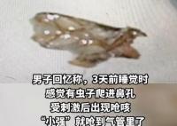 男子睡夢(mèng)中蟑螂從鼻孔嗆進(jìn)氣管 實(shí)在太嚇人了