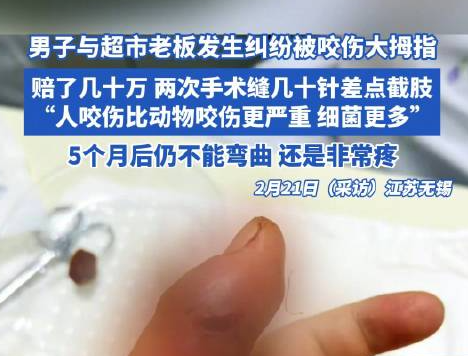 男子因糾紛被超市老板咬傷險(xiǎn)截肢 背后真相實(shí)在讓人驚愕