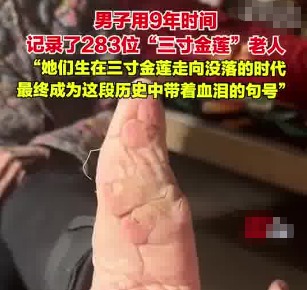 男子用9年時(shí)間記錄了283位裹腳老人 為什么引爭(zhēng)議？