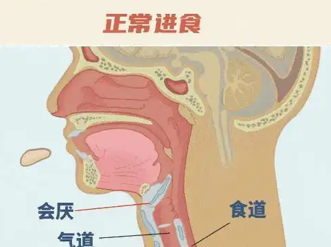 26歲女孩突發(fā)會厭炎僅10分鐘去世 實(shí)在太可怕了