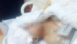 貴州一男子被野豬咬成重傷 究竟是怎么回事？