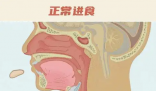26歲女孩突發(fā)會厭炎僅10分鐘去世 實(shí)在太可怕了