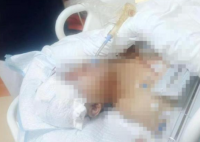 貴州一男子被野豬咬成重傷 究竟是怎么回事？