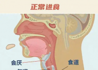 26歲女孩突發(fā)會(huì)厭炎僅10分鐘去世 實(shí)在太可怕了