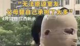 全身90%燒傷男生說父母借錢太心酸 究竟是怎么回事？