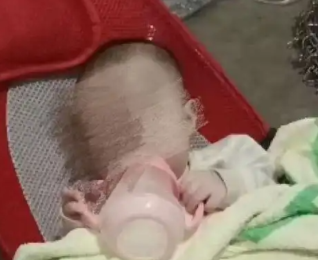 8個月女嬰被餓成皮包骨 當?shù)鼗貞?到底是什么情況？