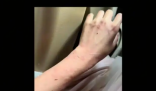 女演員貴州拍戲遇極端天氣 胳膊受傷 實(shí)在太嚇人了